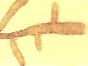 tuber-magnatum-micorriza